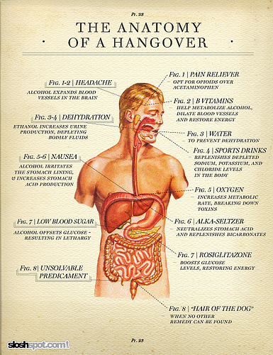 A hangover is the interaction of different obnoxious physiological impacts accompanying considerable devouring of hard drinks. The most ordinarily reported aspects of an after-effect incorporate migraine, sickness, affectability to light […]