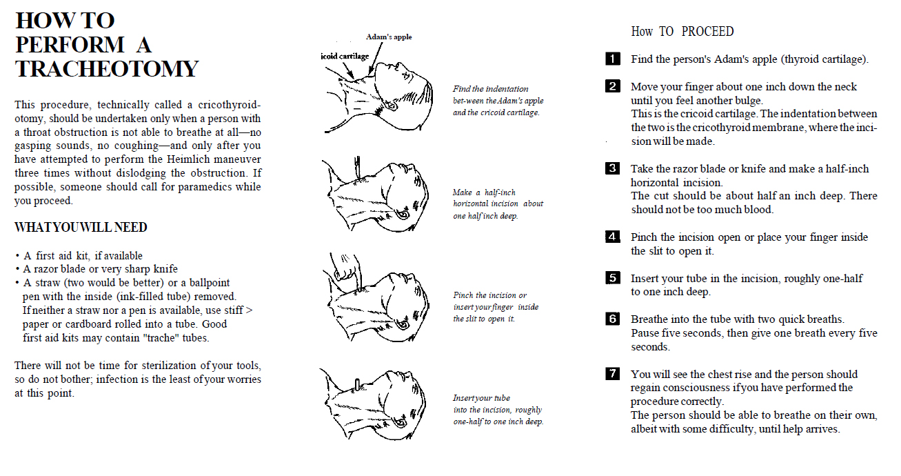 This strategy, particularly called a cricothyroidotomy, ought to be undertaken just when an individual with a throat obstacle is not fit to inhale to any detectable degree, no panting sounds, […]