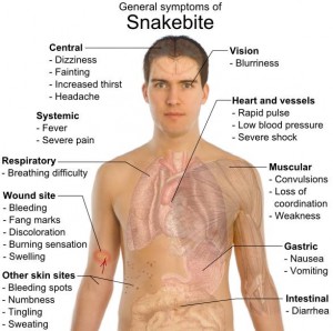 Snakebite Symptoms