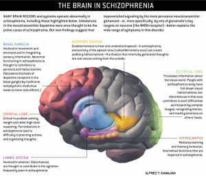 The Brain & Schizophrenia