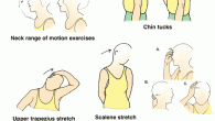 Neck practices are a regular part of well-nigh any medicine system for neck torment. A regular neck practice project will comprise of a blending of extending and fortifying actions, vigorous […]